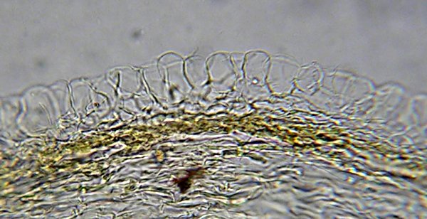 Pileipellis of Agrocybe acericola